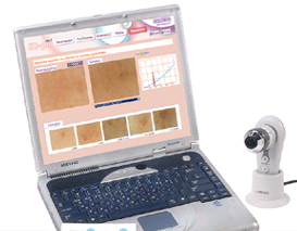 SD-pro skin Diagnosis System